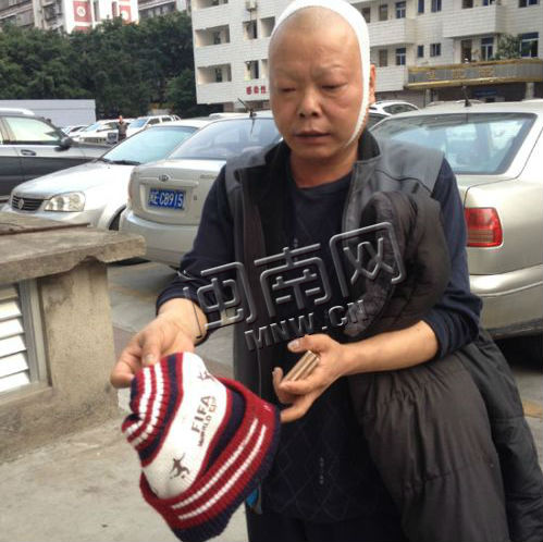 老汤说,幸好当时戴着帽子,不然可能受伤更严重